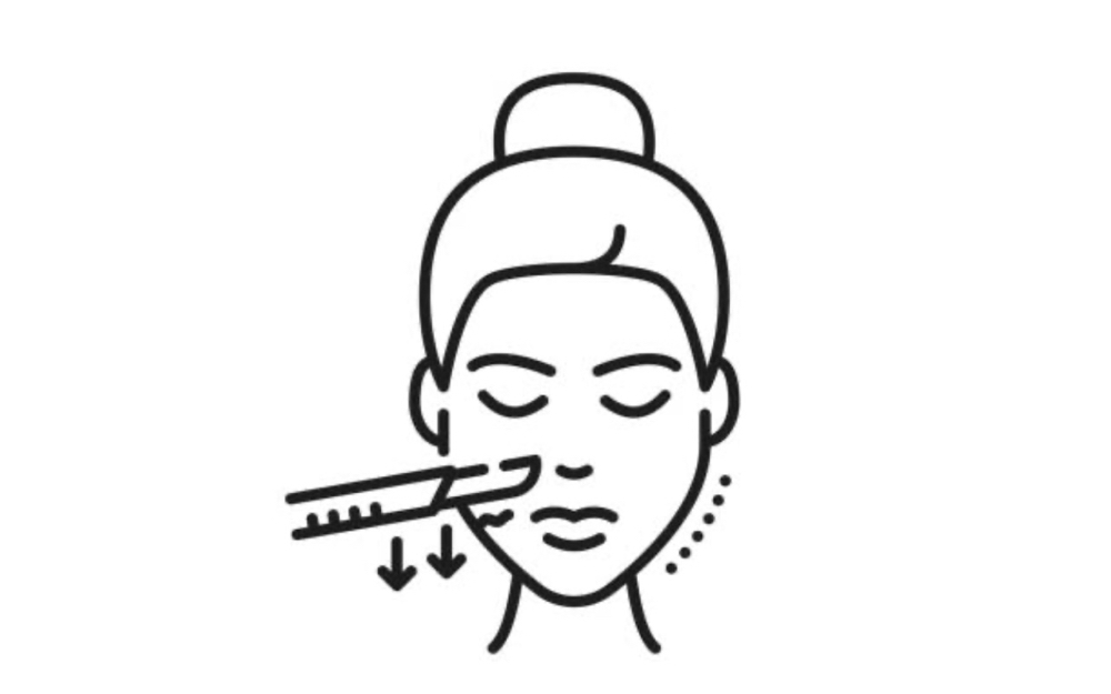 Dermaplane Add On