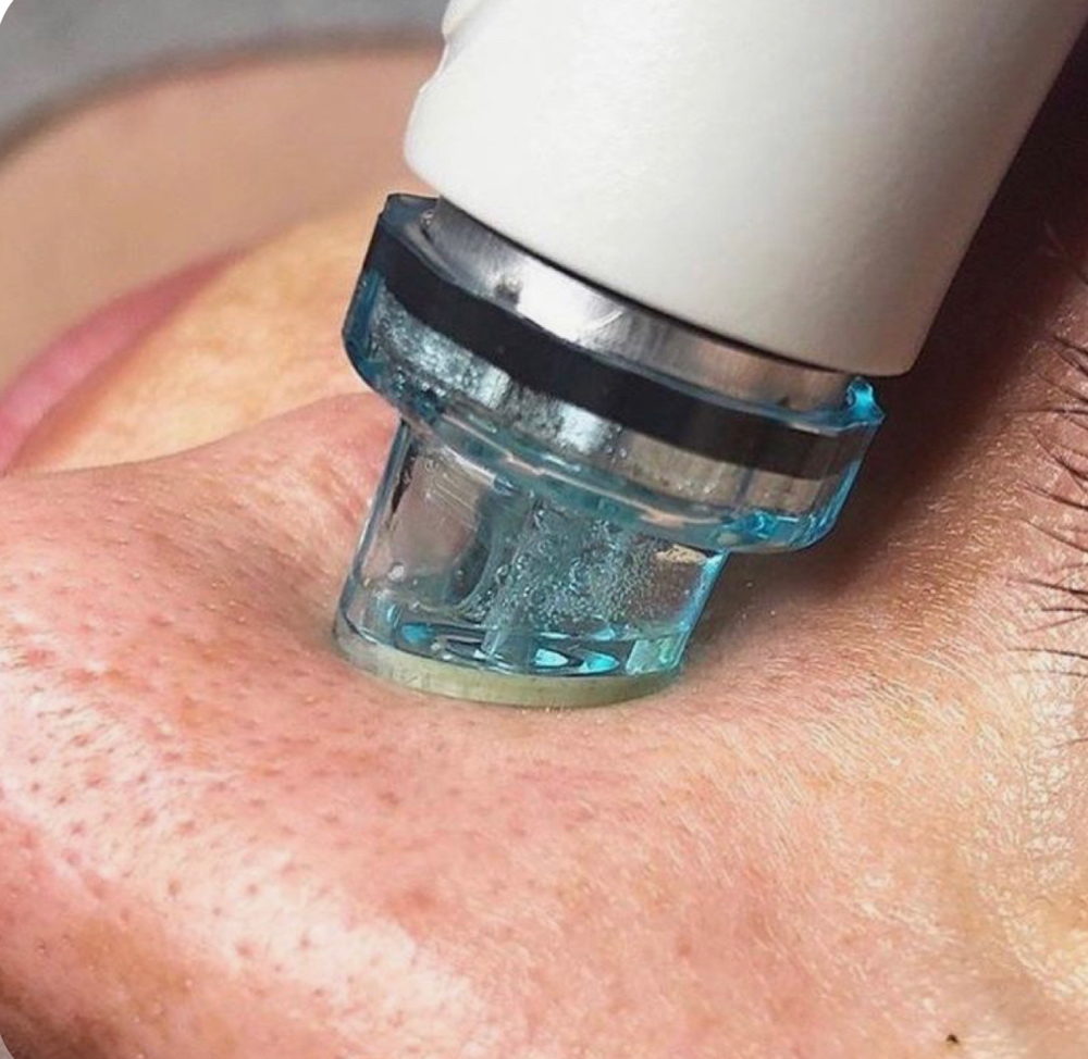 HidraFacial