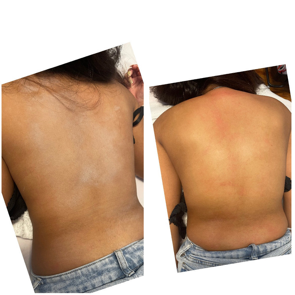Back Wax