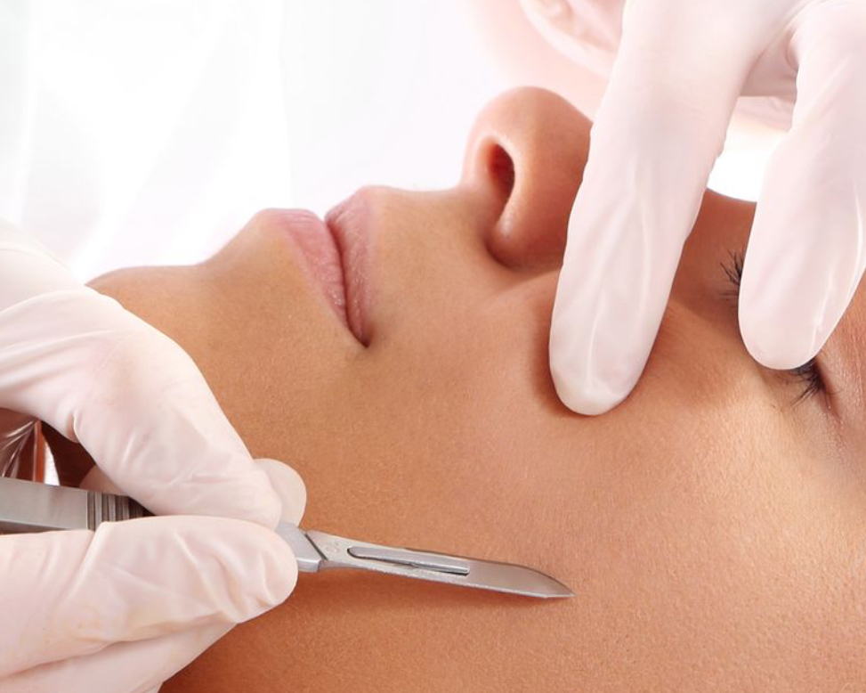 Add On - Dermaplane