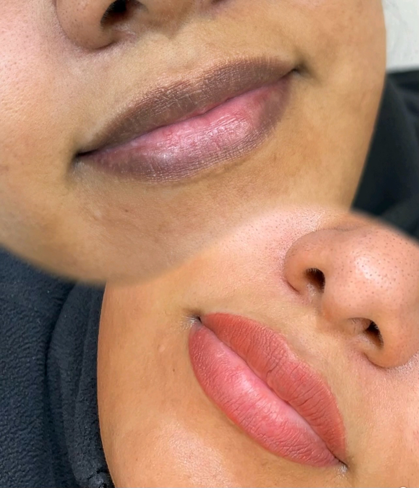 Lip Neutralization