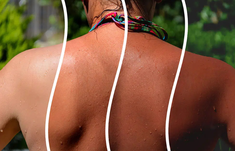 Spray Tan