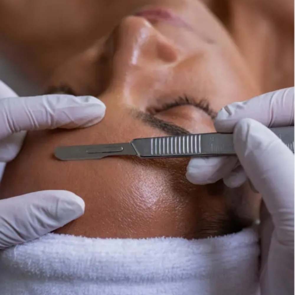 Dermaplaning Facial at Radiant Skin by Alison in Wilmington, NC