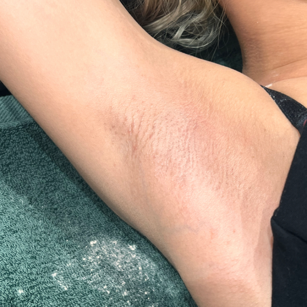 Underarm at Sugar Babies Beauty & Co. in Lakeland, FL