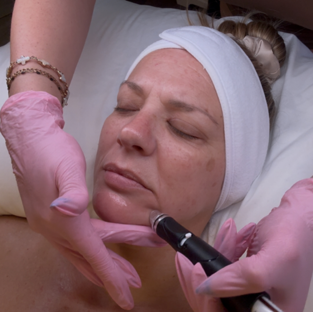 GLOWING GODDESS at Mattie’s Aesthetics in Aptos, CA