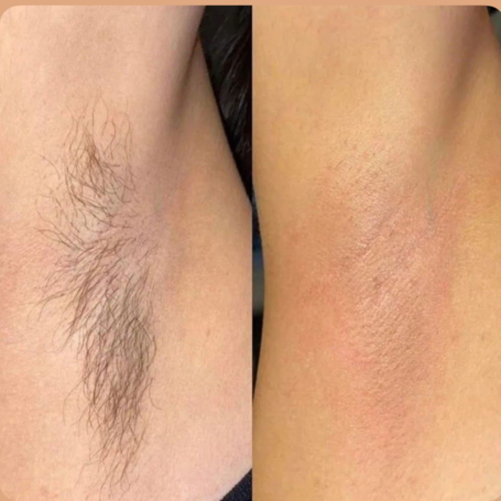 Underarm Wax at Bre & Me Esthetics in Delaware, OH
