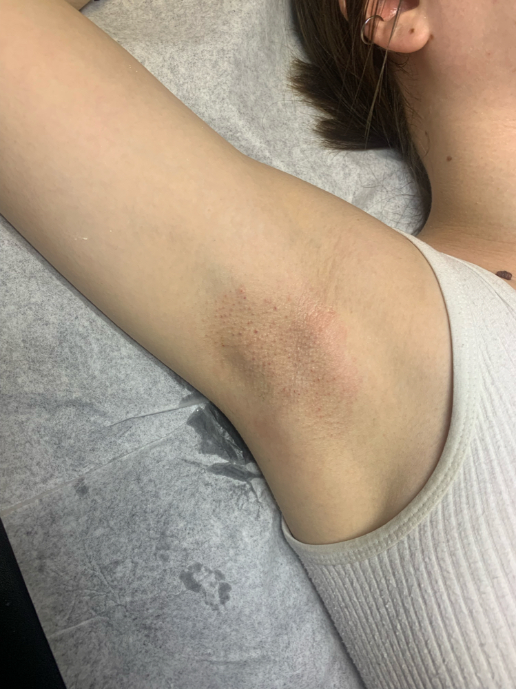 Underarm Wax