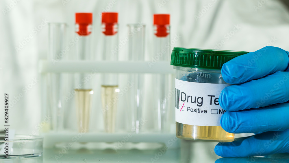 5 PANEL URINE DRUG TEST (INSTANT)