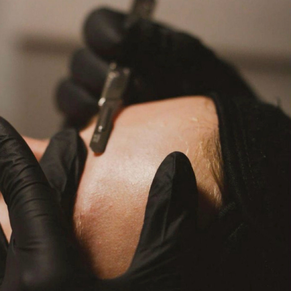 Dermaplaning Facial at Esther Esthetics in Suwanee, GA