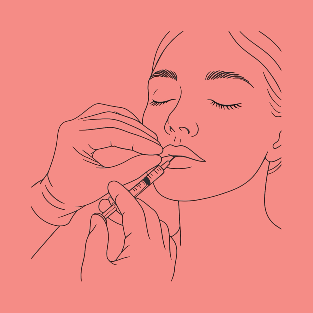 Half Syringe Lip Filler (0.5 mL)