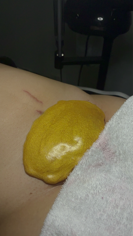 Brazilian/Vajacial + underarm Promo