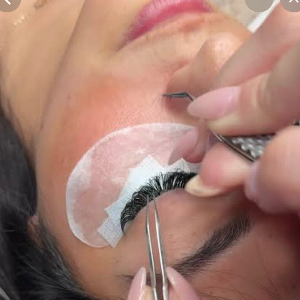Volume Fill (4 Weeks) at Aura Aesthetics spa in Houston, TX