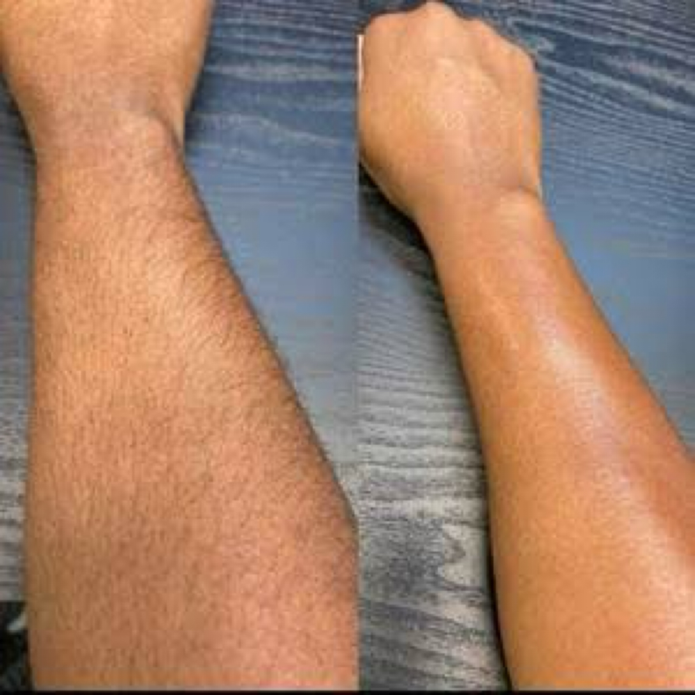 Half Arm at Belladz Wax Studio in Beltsville, MD