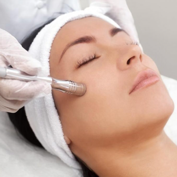 Microdermabrasion Facial at Rose & Balance Skin Studio in San Diego, CA