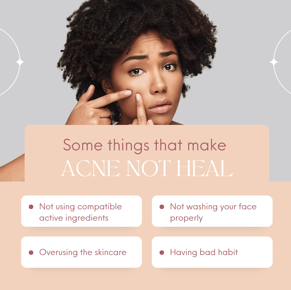 Acne Bootcamp: 12 Weeks