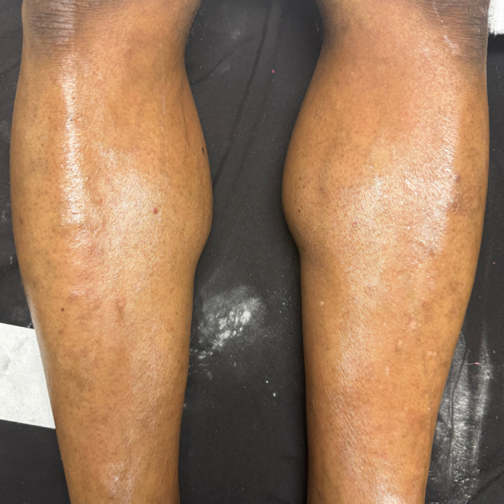 Leg Wax at Tekila’s Timeless Touch in Flint, MI