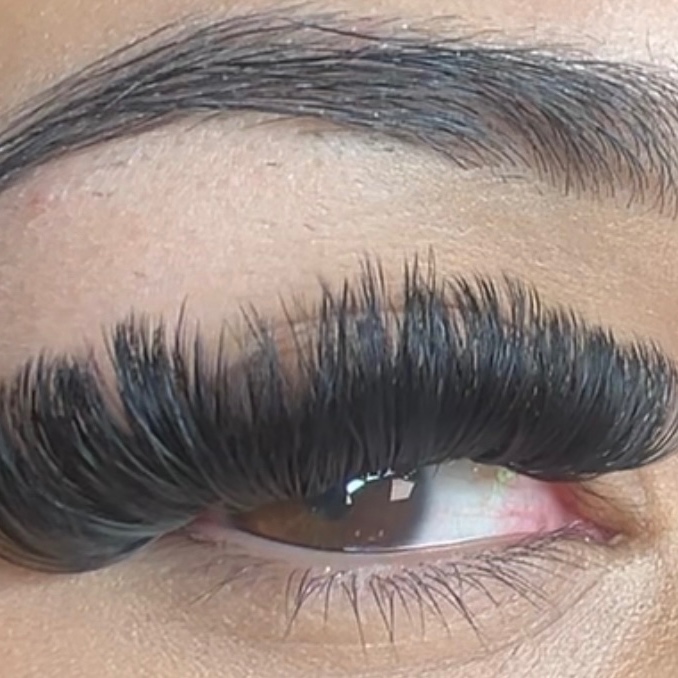 Mega Volume Fill at Ooh la la Aesthetics in Amarillo, TX