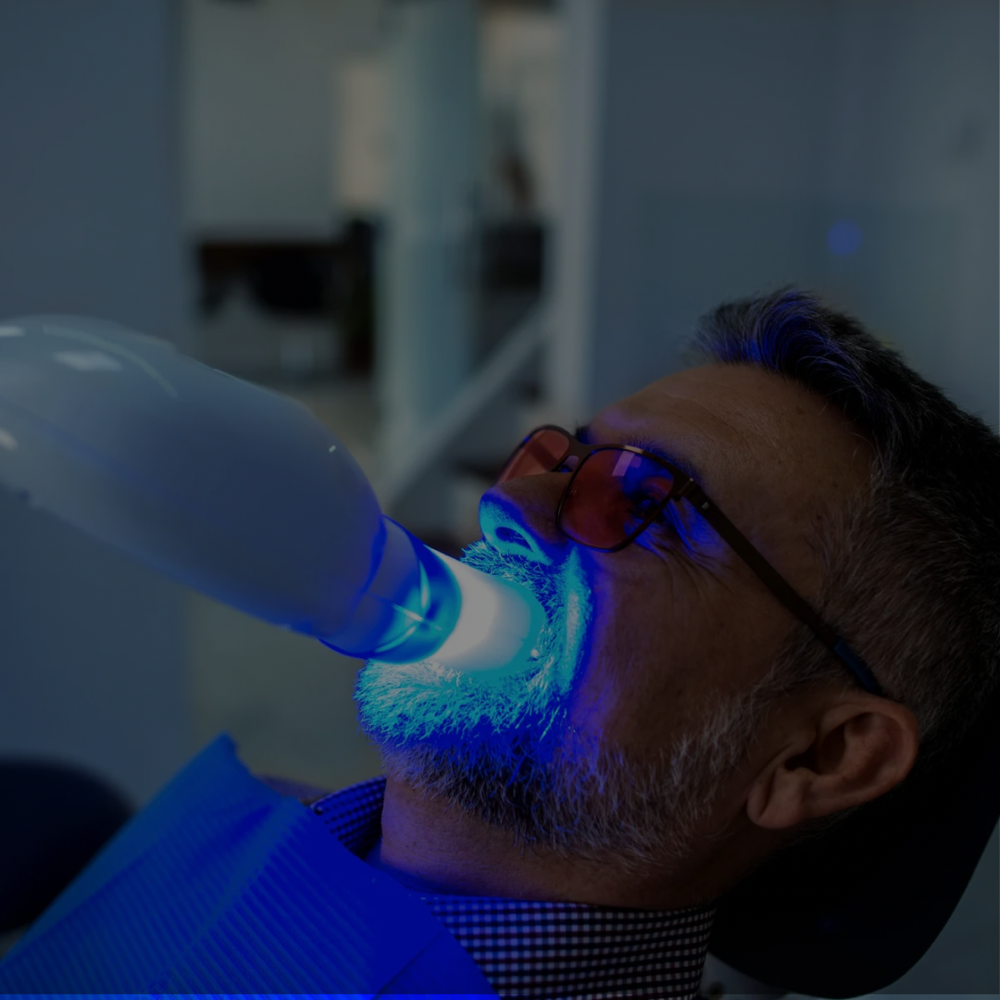 45 Minute Teeth Whitening