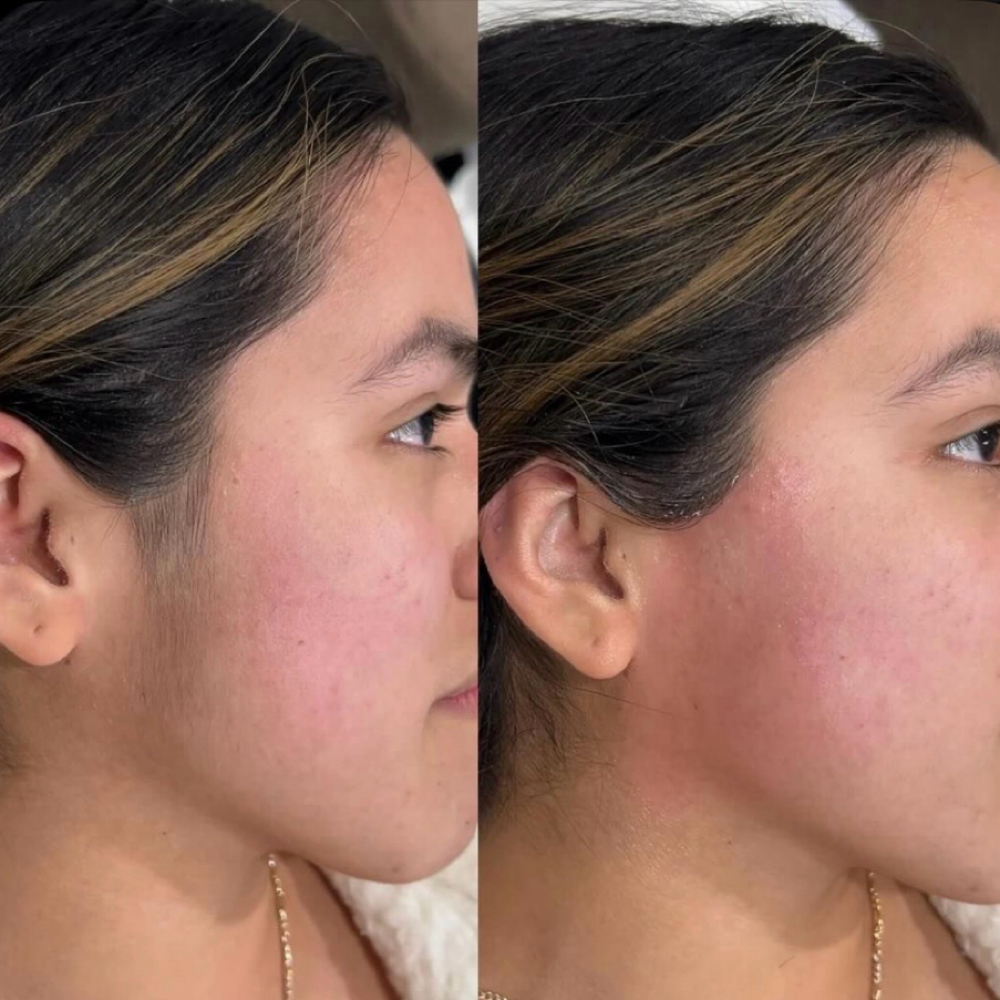 Side Burns at Divine Uplift Beauty in Upon Booking, NY