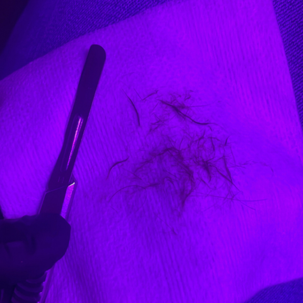 Dermaplaning Detox Facial at Exquisite Studios in Lady Lake, FL