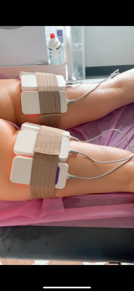 Laser Lipo at LuxBeautique in Pawtucket, RI