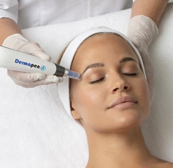 Microneedling