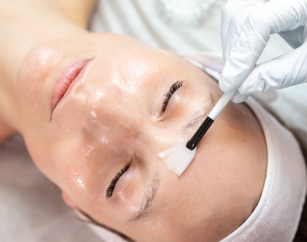 Customized Chemical Peel at Glory Esthetics in Riverside, CA