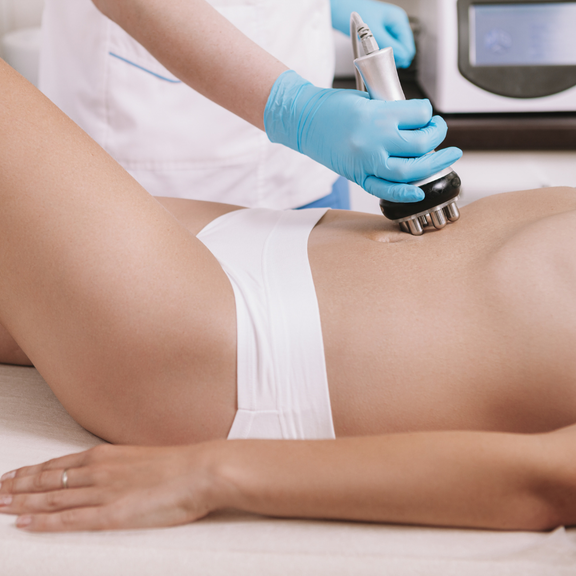 Body Radiofrequency