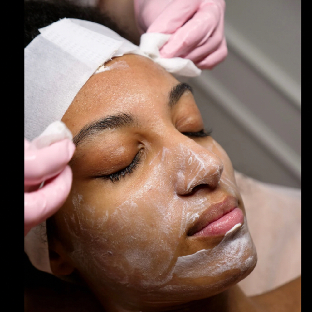 Clarifying Acne Facial at Jenn B Skin in Hamden, CT