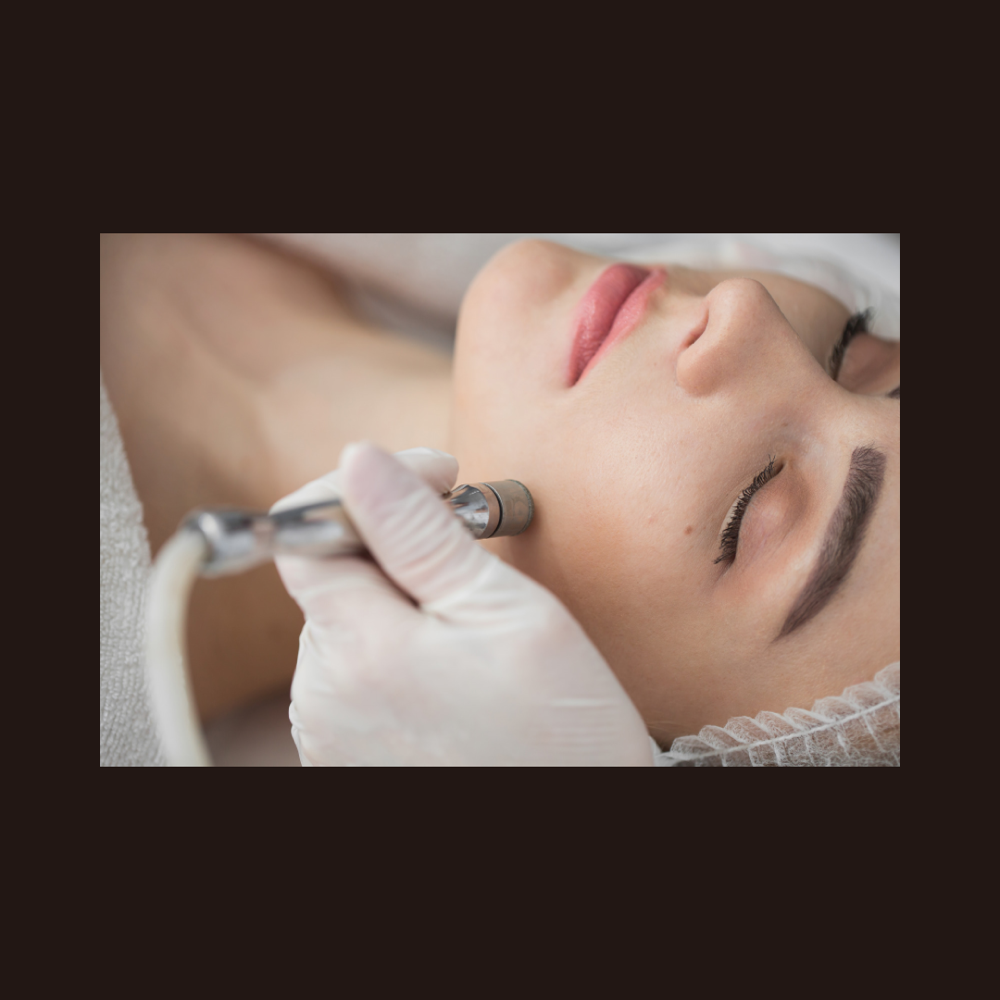 Microdermabrasion Facial