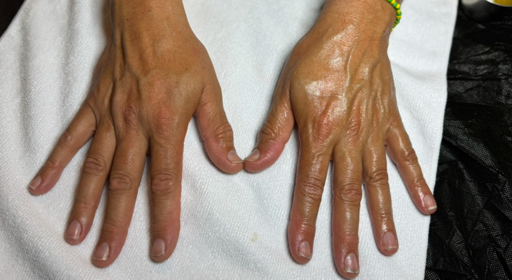 Moisturizing Hand Treatment