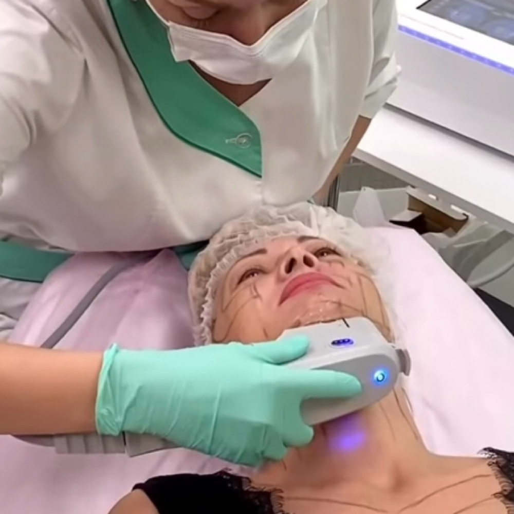 Hifu Skin Tightening at Extreme Body Scultping in Edgewood, MD