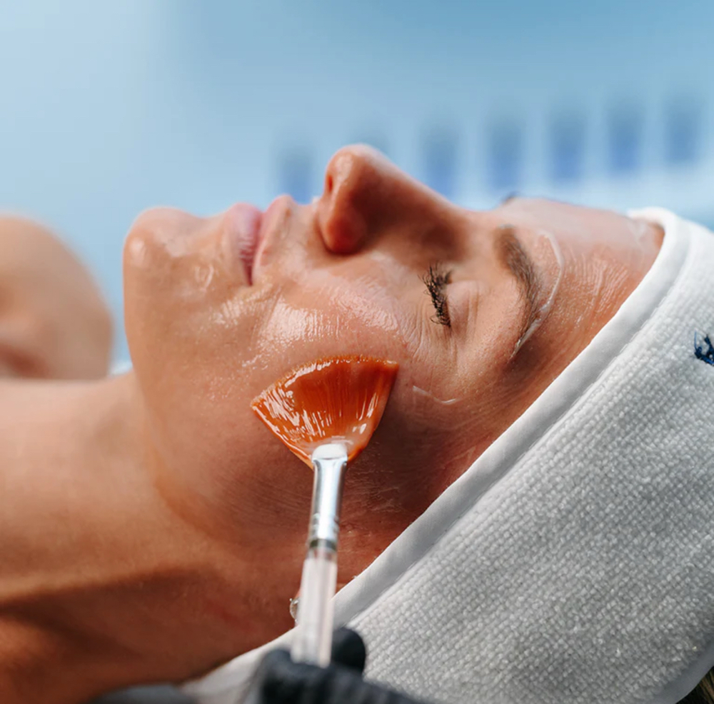 SWiTCH Dermal Rejuvenation System