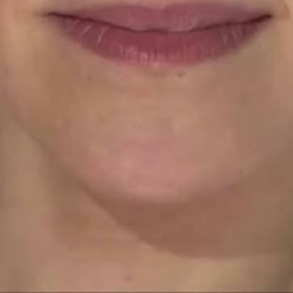 Chin at iSugar Waxing Studio in Redondo Beach, CA