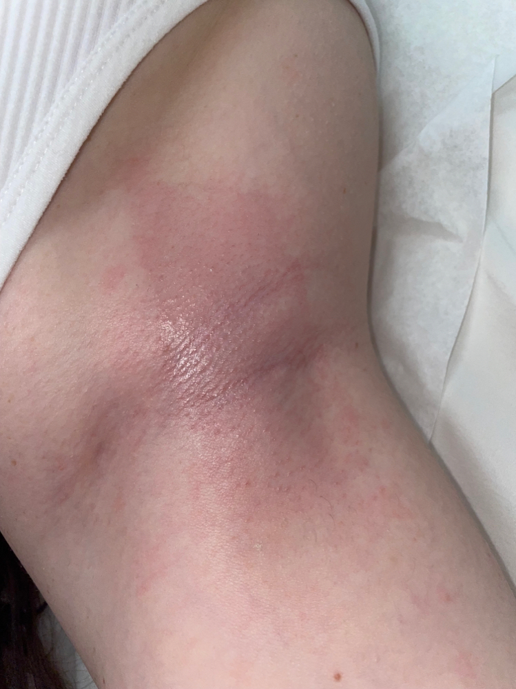 Under Arm Wax