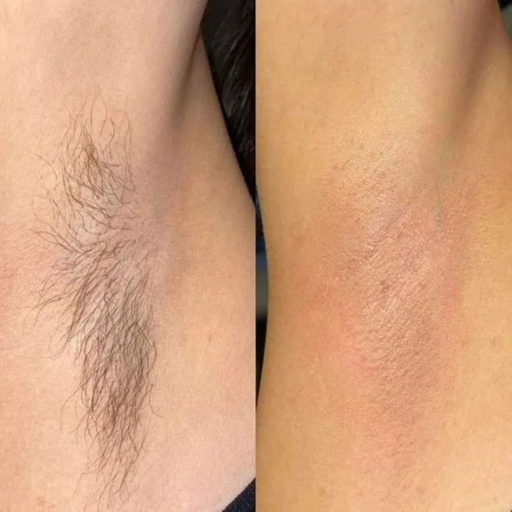 Under Arm Wax at Shine by Simone in North Wales, PA