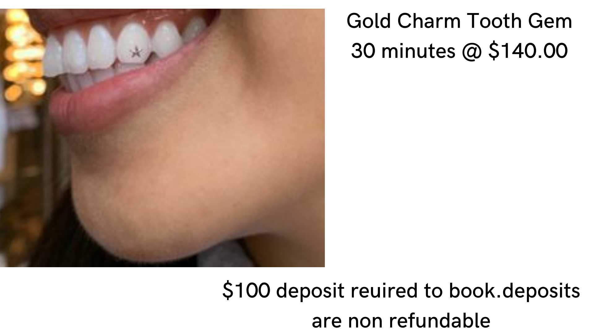 Gold Charm Tooth Gem