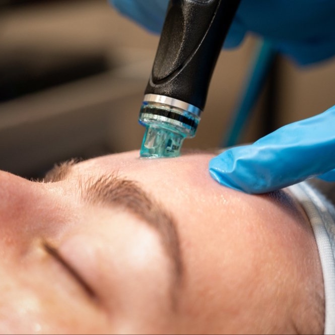 Deluxe Hydrafacial at Pure Aesthetics and Wellness LLC in Leitchfield, KY