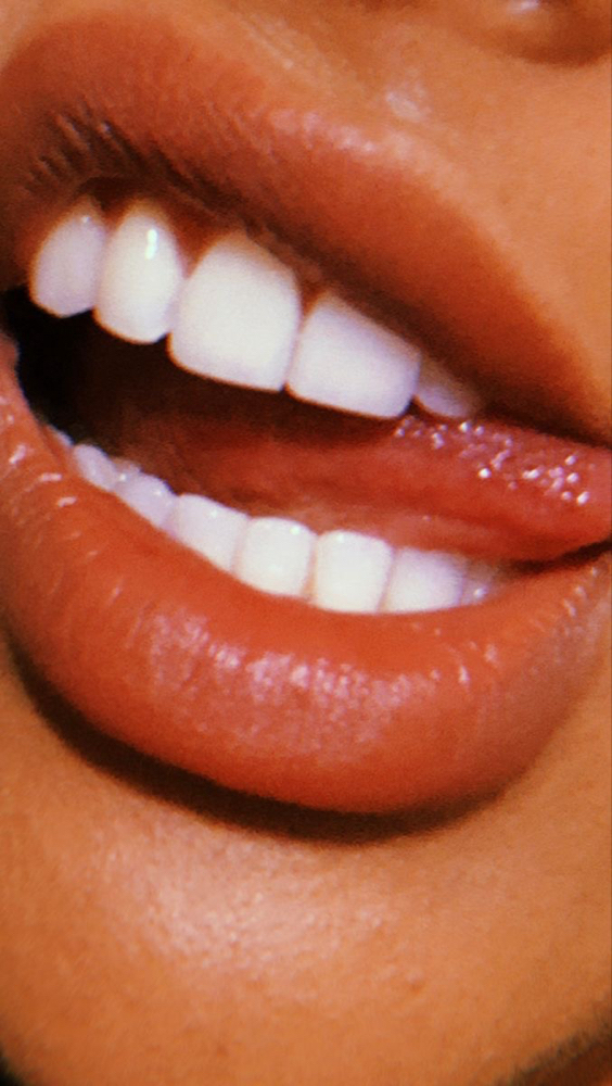 DaVinci Teeth Whitening(2 Sessions)