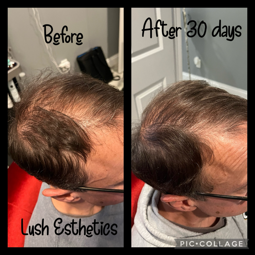 Keravive Hydra Scalp Treatment