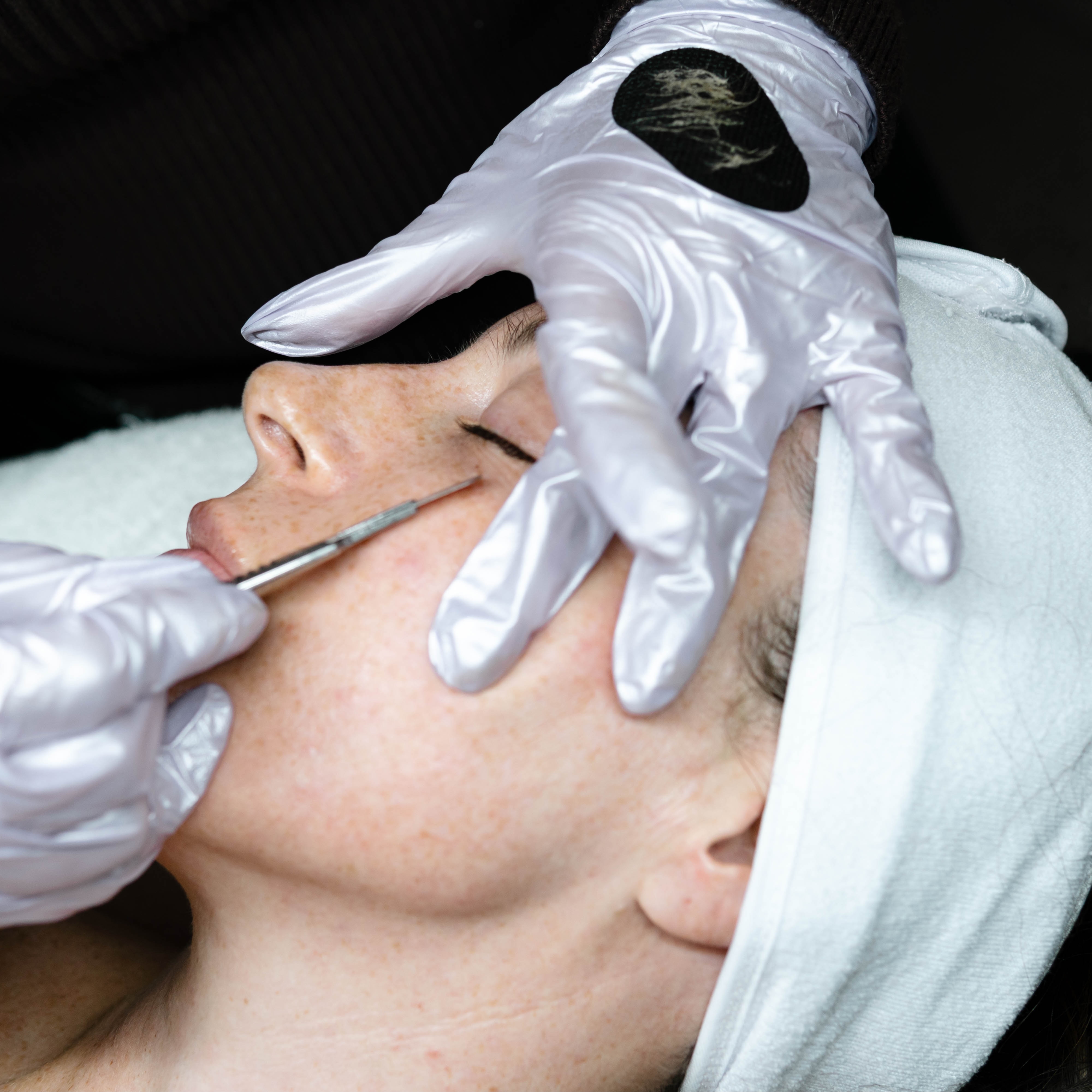 Dermaplane ADD-ON at Ruby Williams Aesthetics LLC in Sarasota, FL