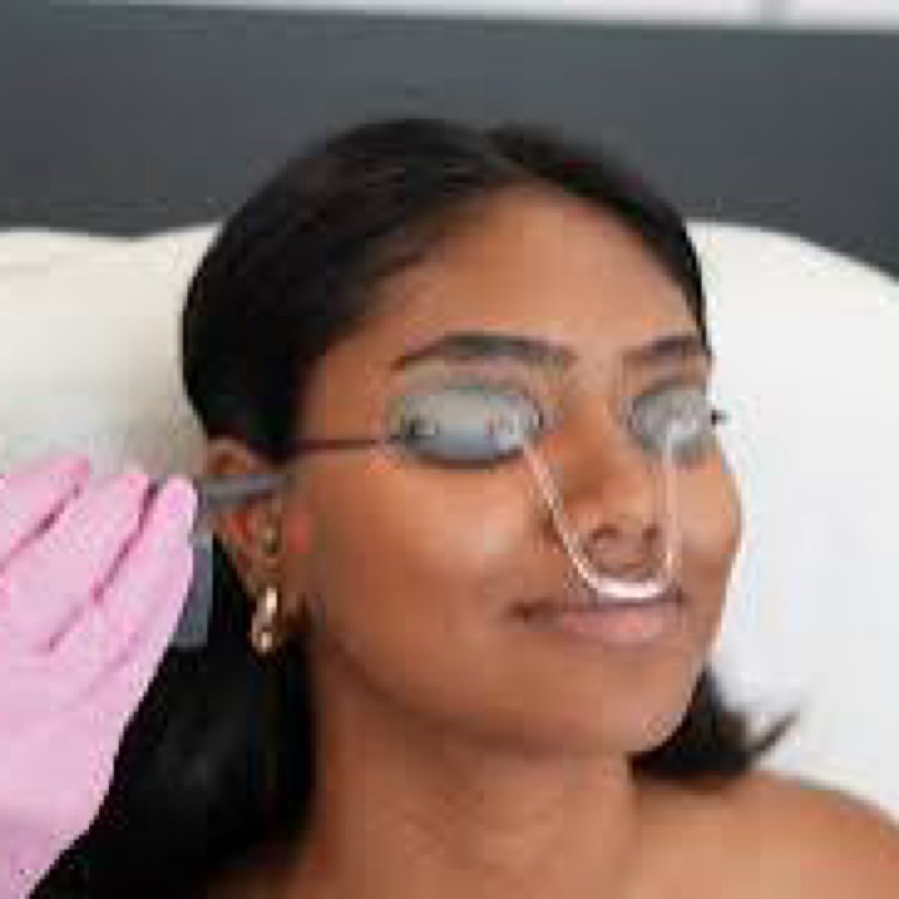 Laser Hair Removal- Side-burns at Chatuge Med Spa & Fitness in Hiawassee, GA