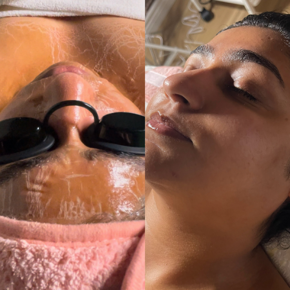 Luxe Lift & Firm at Radiance Aesthetics by Aracely in Bakersfield, CA