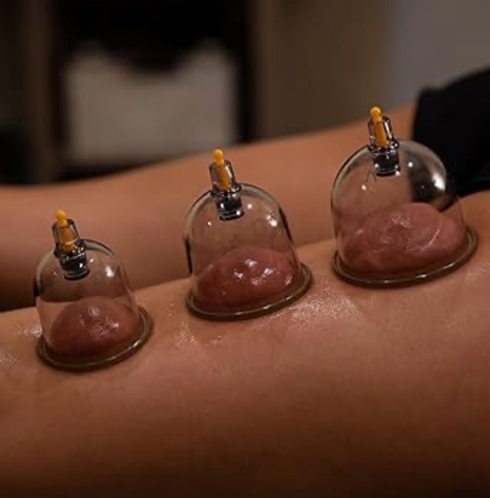 Cupping Session