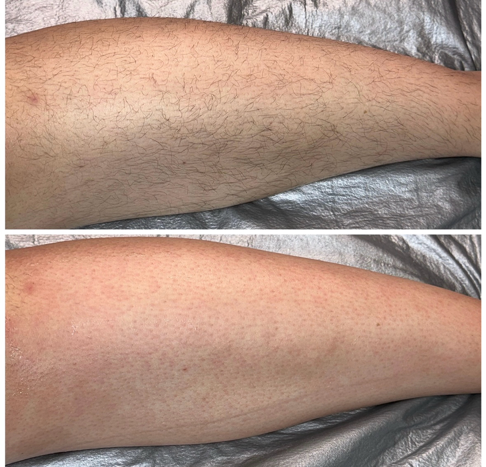 Full leg wax ($70)
