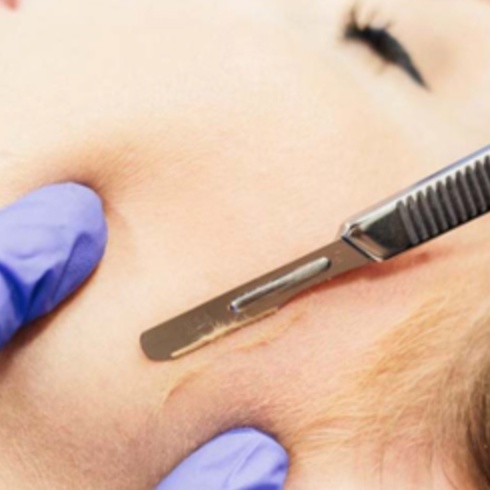Dermaplaning |  Surface Refinement at Empower Aesthetics in Canyon Lake, TX