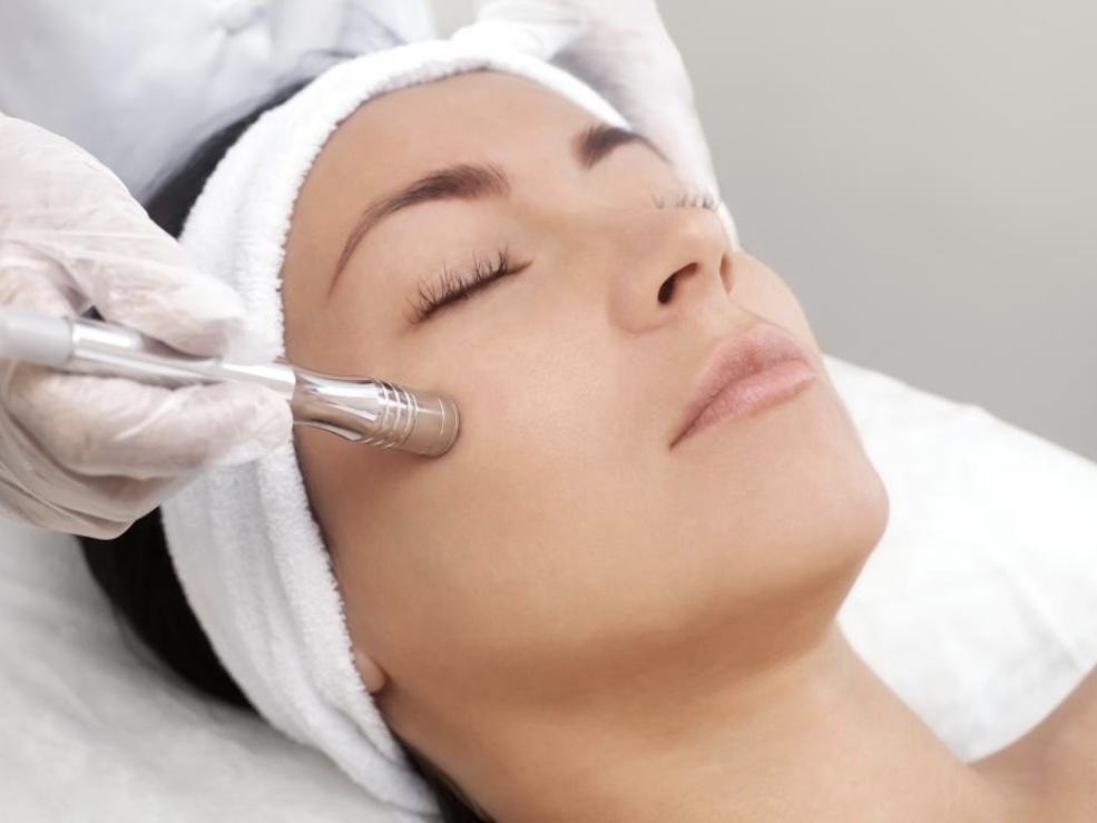 Microdermabrasion