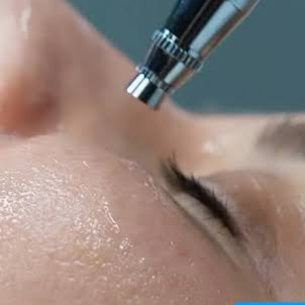 Oxygen Serum Infusion at Sculpting Beauty by Pam LLC in Atascocita, TX
