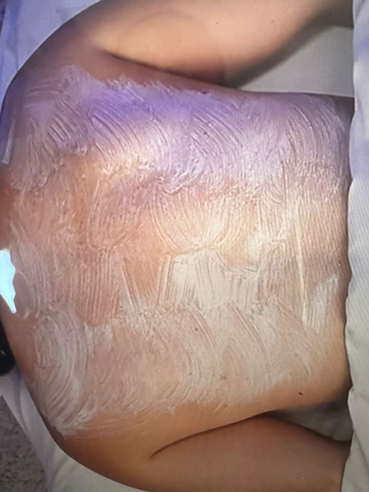 Back Facial