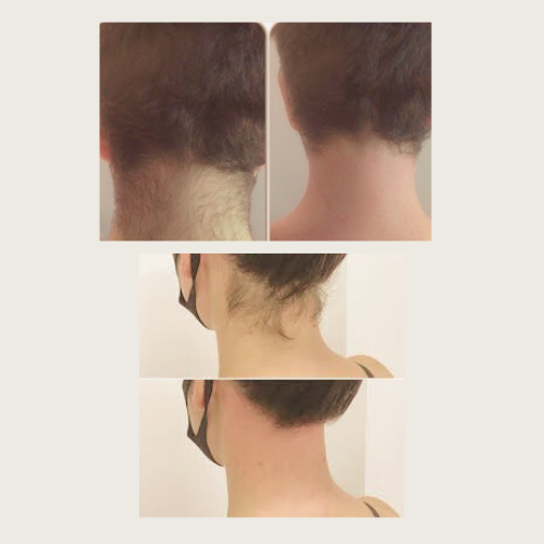 Back of Neck